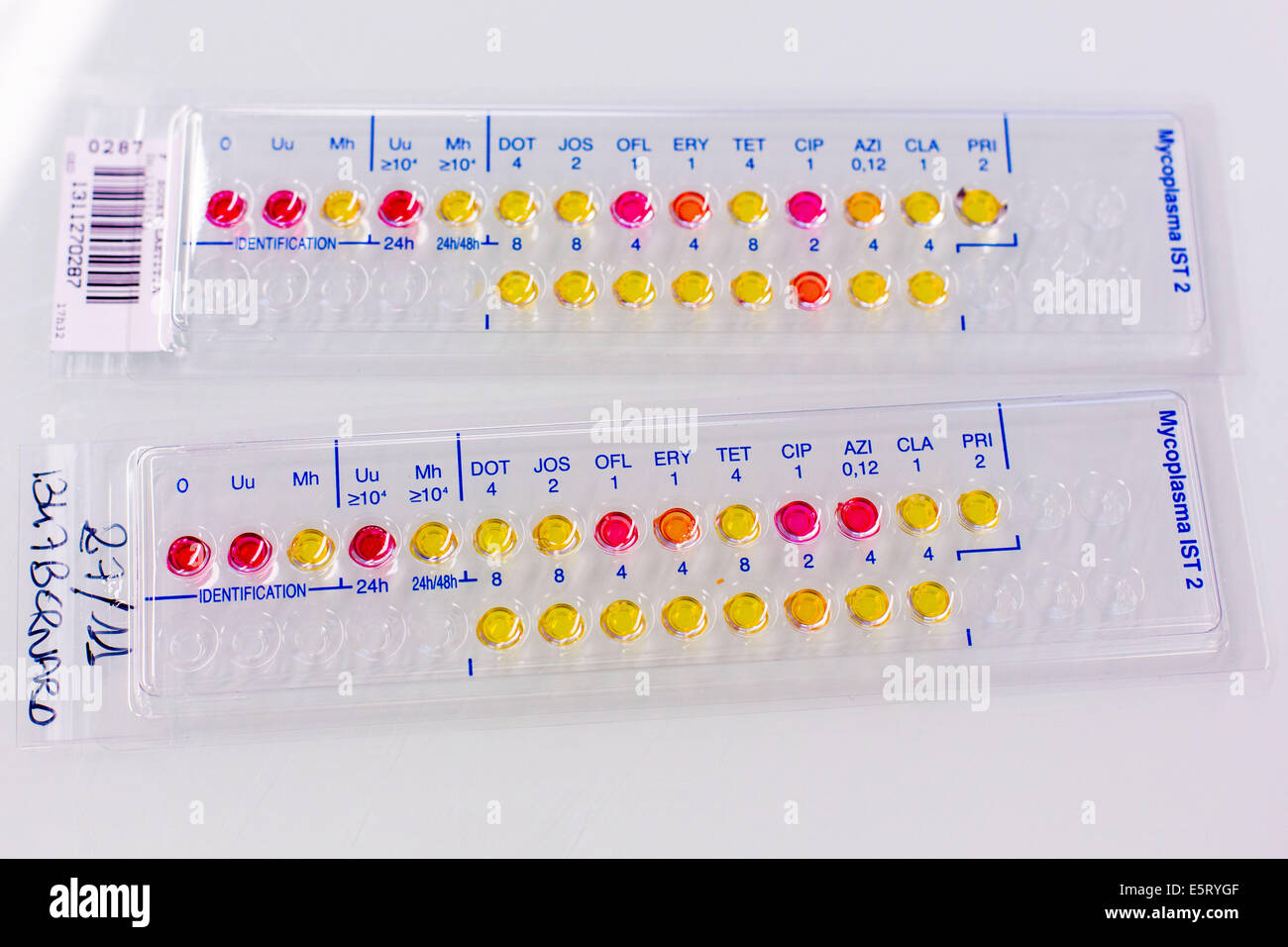 Test bactérien de mycoplasmes urogénitaux. Banque D'Images