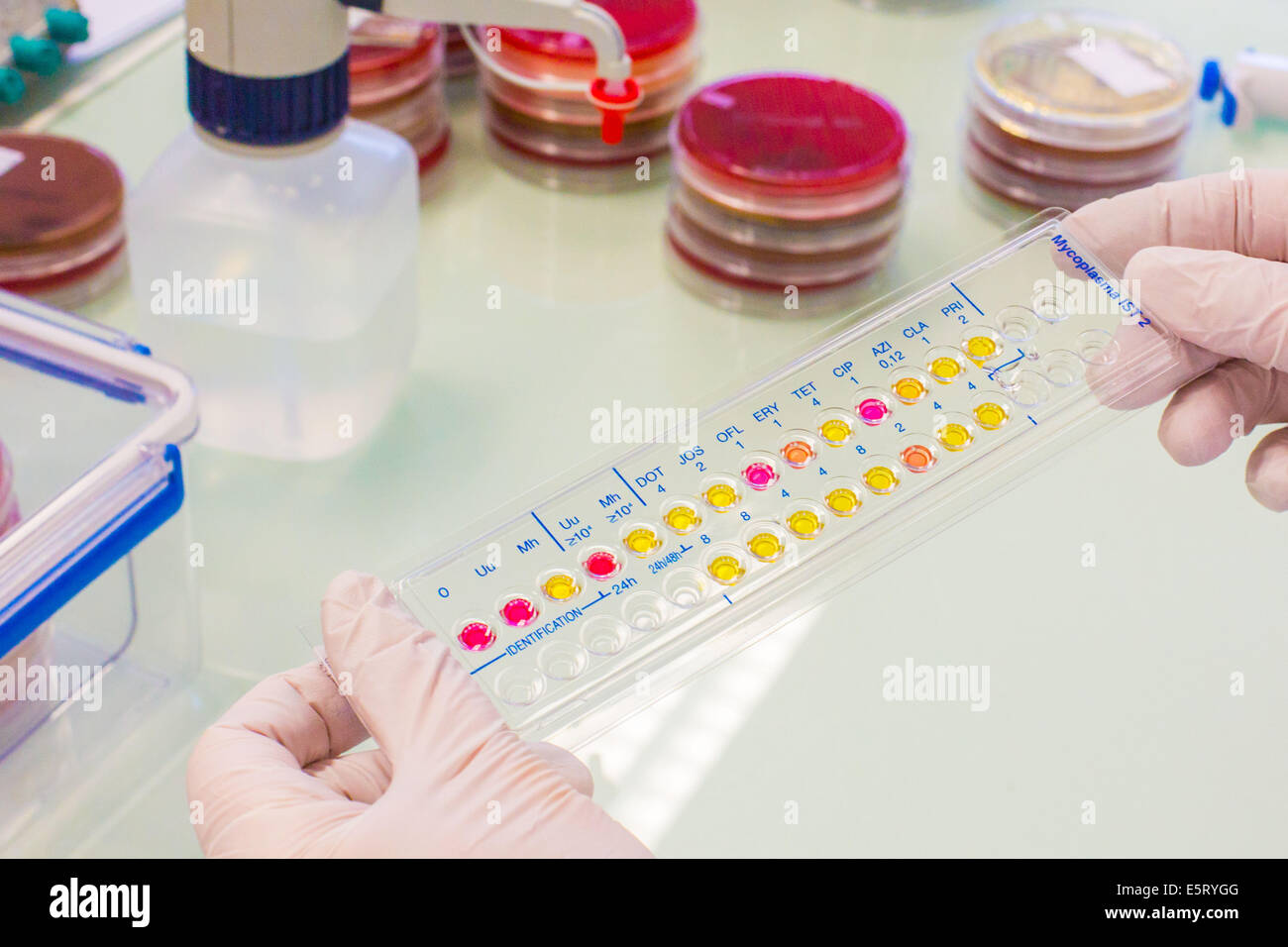 Test bactérien de mycoplasmes urogénitaux. Banque D'Images