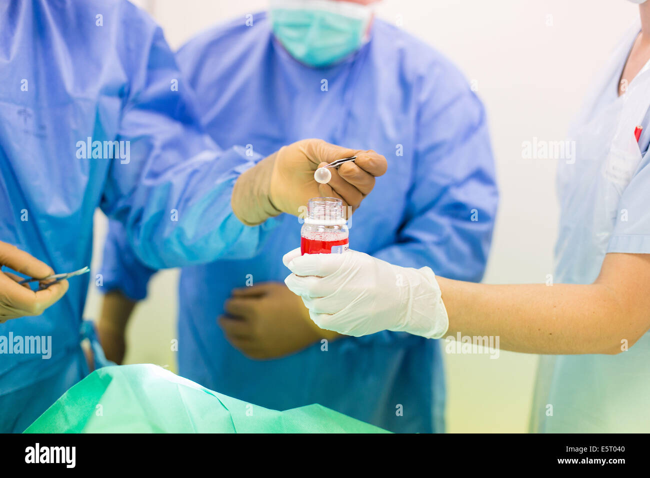 Dépose de la cornée pour la transplantation, hôpital d'Angoulême, France. Banque D'Images