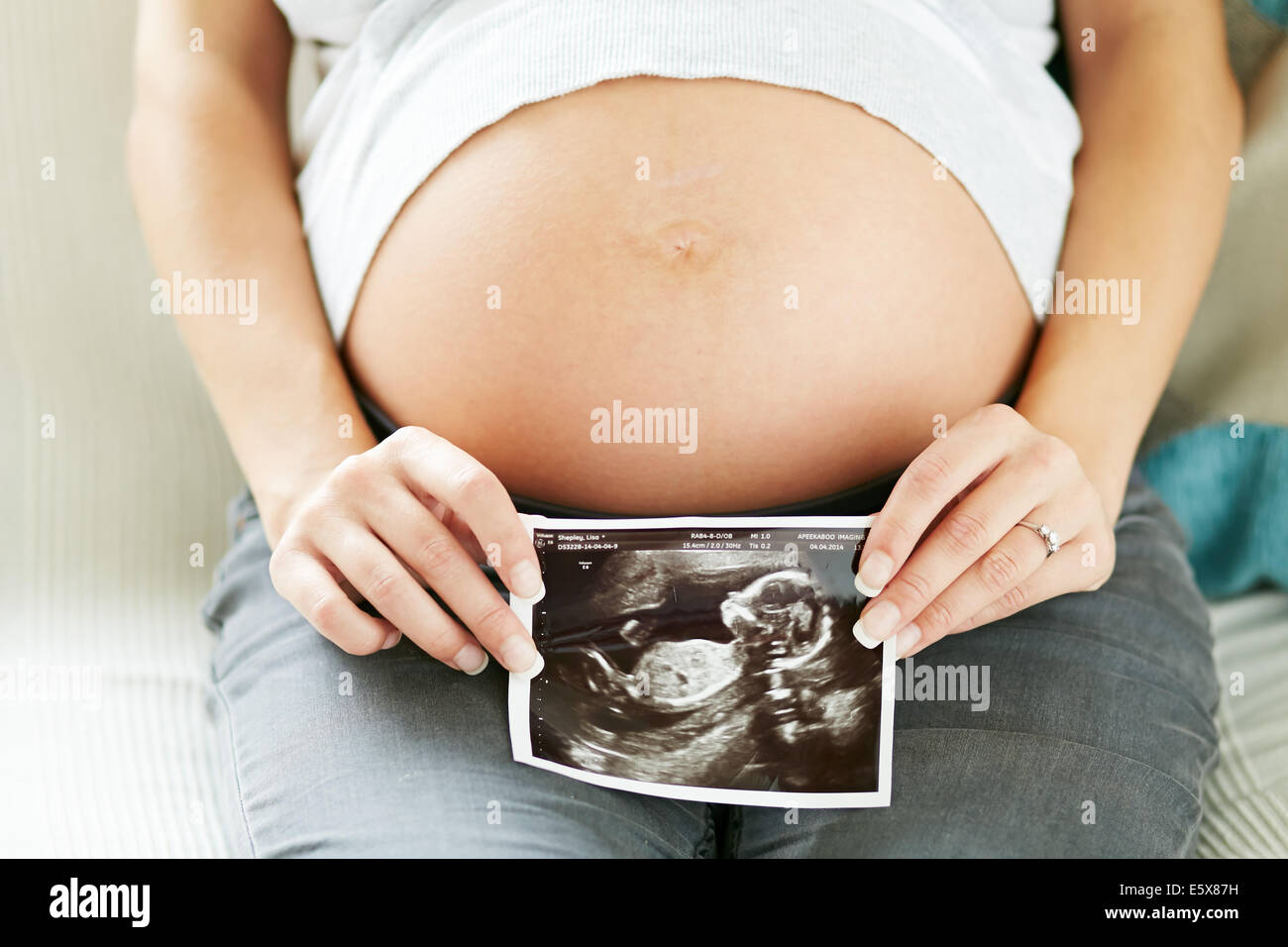 Femme Enceinte Avec La Photo De Bebe Scan Photo Stock Alamy