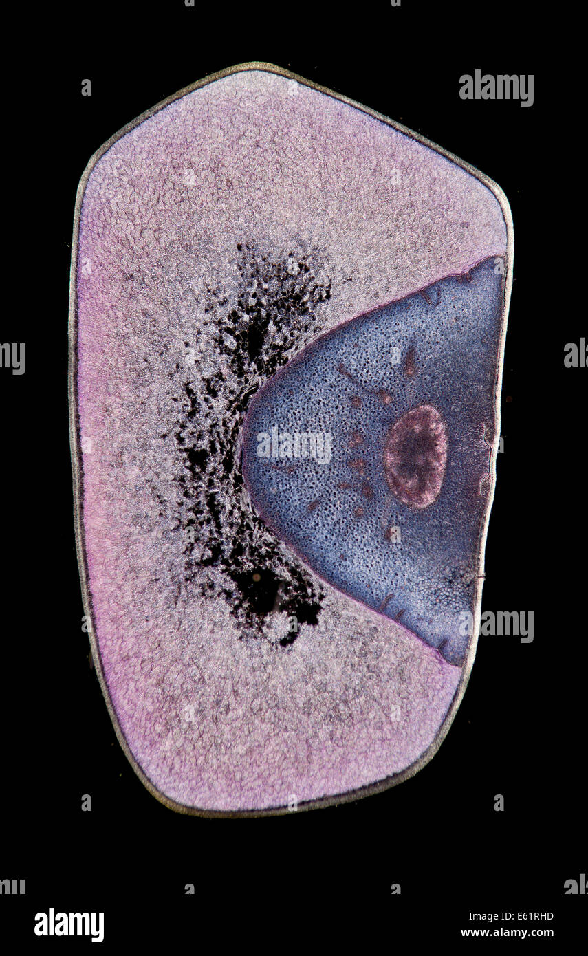 Zea sp. darkfield photomicrographie, signal de l'article par embryon Banque D'Images