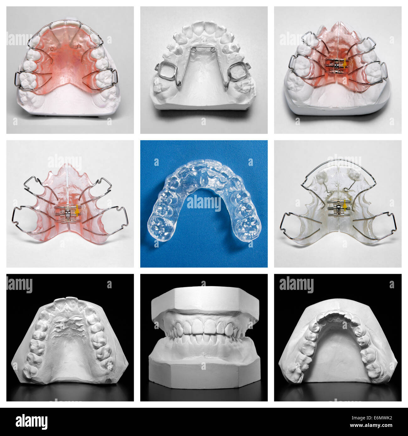 Compilation photo de retenue de essix entouré par les appareils orthodontiques et des modèles d'étude Banque D'Images