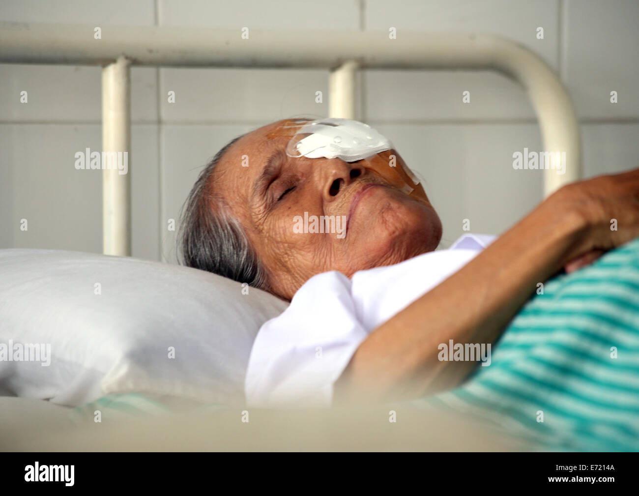 Yangon, Myanmar. 16Th Jun 2014. Un patient porte un pansement oculaire après la chirurgie à Yangon, Myanmar, le 4 septembre 2014. Une équipe médicale chinoise a commencé une campagne de traitement chirurgical de l'œil à Yangon jeudi que la troisième du genre de 'Action' de la luminosité dans le pays. Credit : U Aung/Xinhua/Alamy Live News Banque D'Images