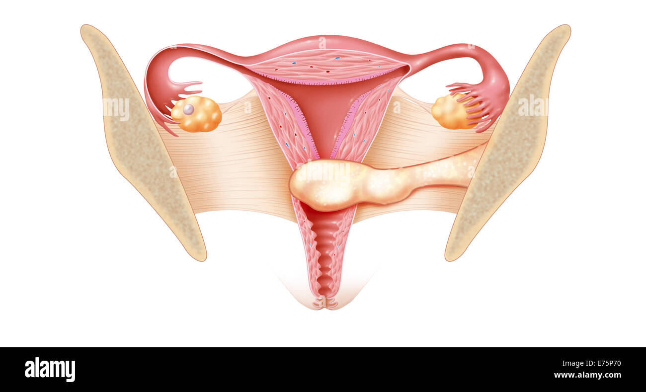 Le cancer du col de l'utérus, dessin Banque D'Images