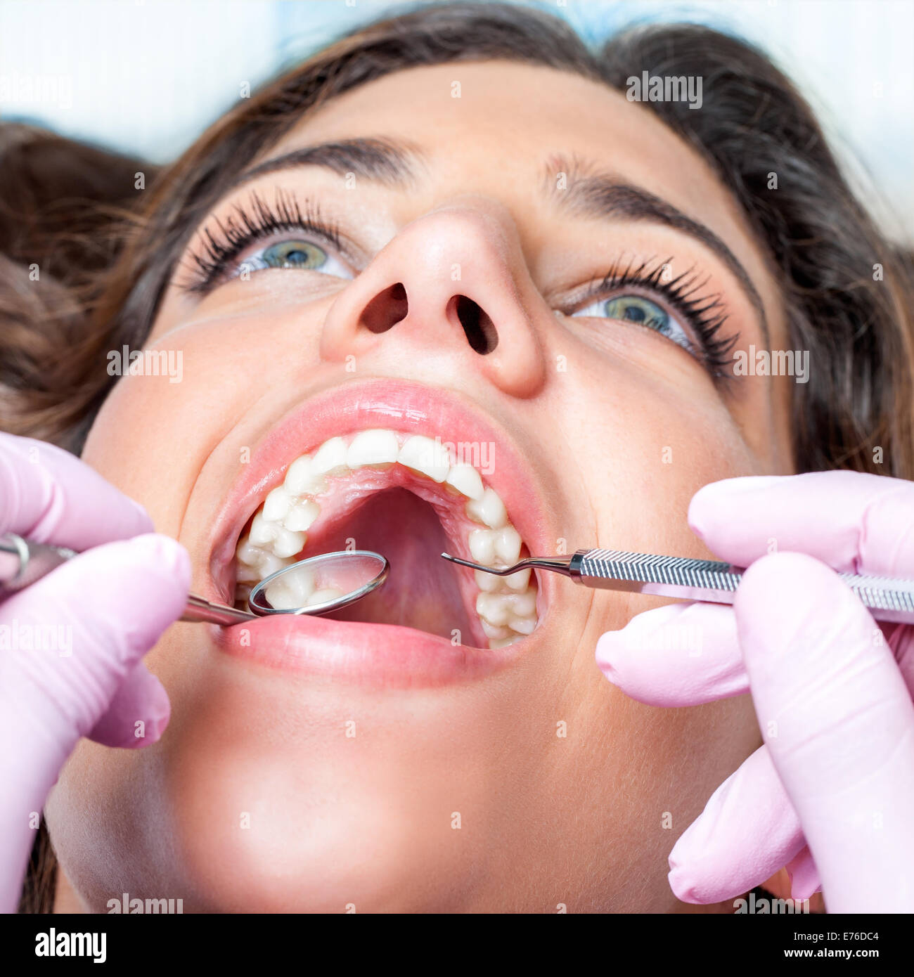 Extreme close up of Woman avec la bouche ouverte au check up dentaire Banque D'Images