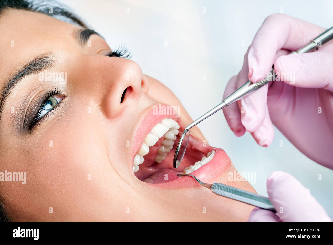 Macro close up of woman's check up dentaire en clinique. Banque D'Images