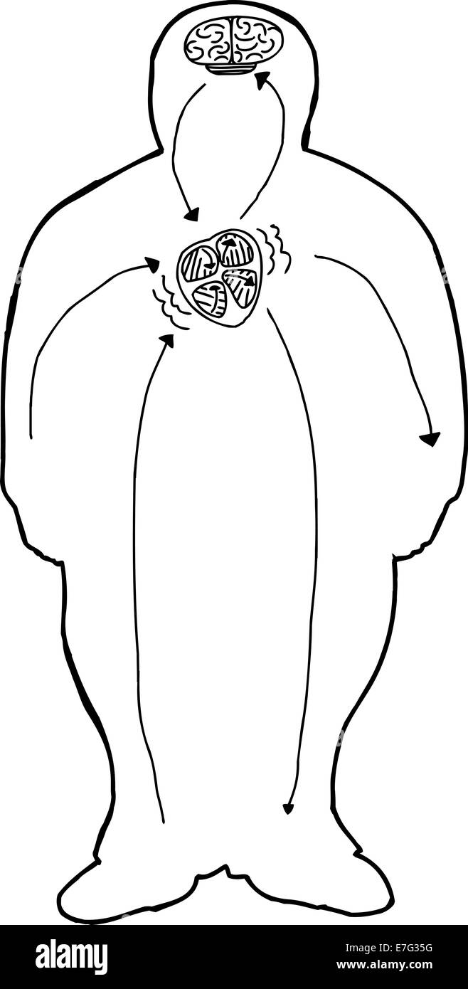 Les accidents vasculaires cérébraux et les maladies du cœur graphique cartoon aperçu Banque D'Images