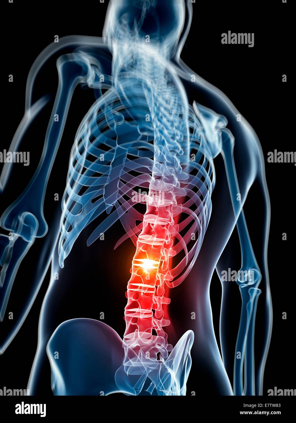 Colonne lombaire, l'oeuvre de l'ordinateur. Banque D'Images