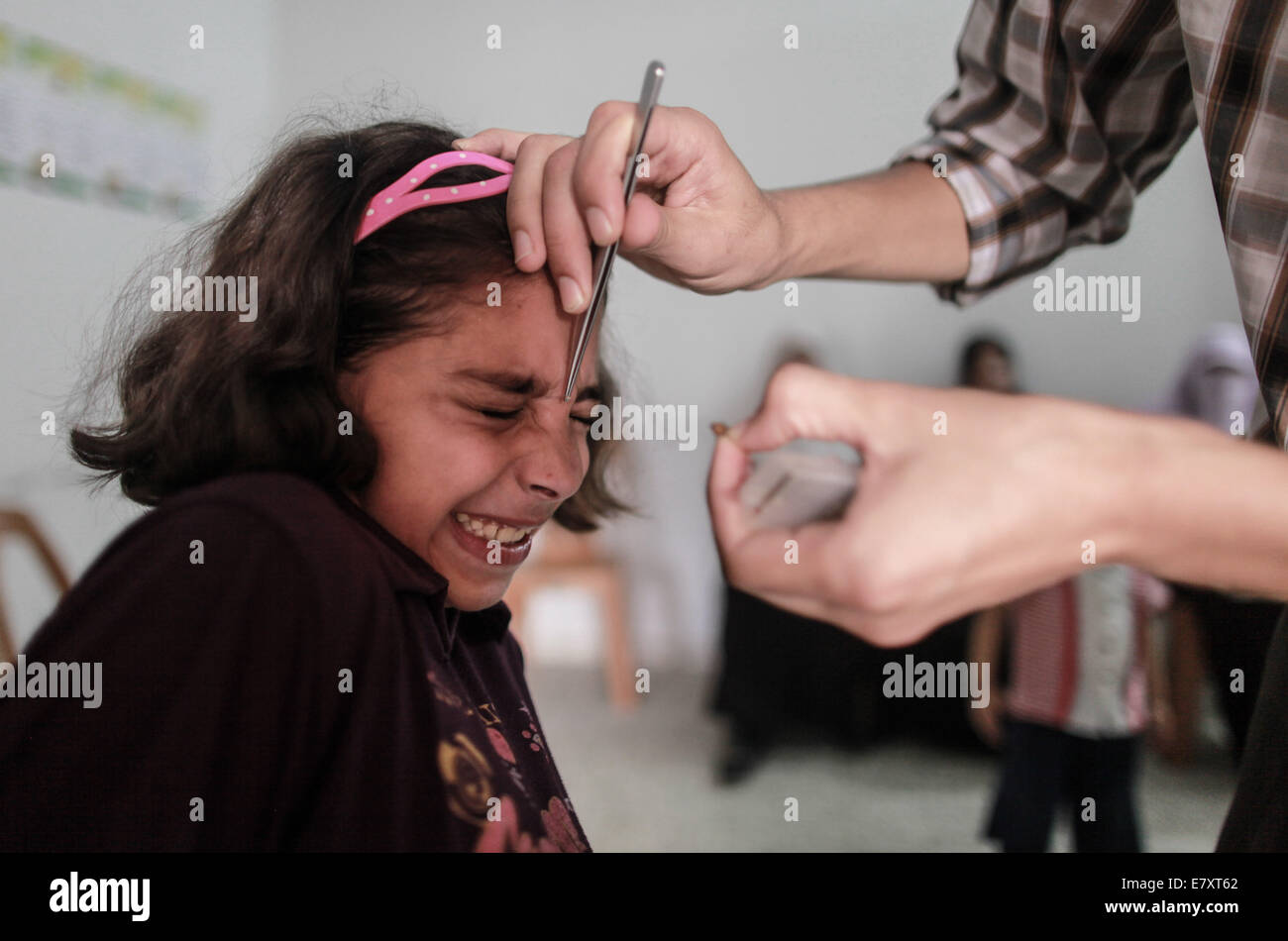 La bande de Gaza. 25 Septembre, 2014. Un Palestinien bee-thérapeute sting sting supprime la gauche sur le visage du patient dans la ville de Gaza, sur Sept 25, 2014. À l'abeille-sting clinique, les patients reçoivent un traitement par piqûres d'abeilles, pour de nombreuses maladies comme la polyarthrite rhumatoïde, maladies du coeur, des problèmes d'audition, l'insuffisance rénale, l'épilepsie, l'allergie nasale et l'autisme. © Wissam Nassar/Xinhua/Alamy Live News Banque D'Images