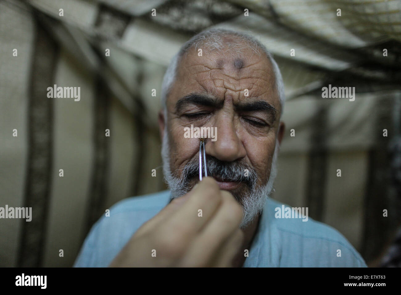 La bande de Gaza. 25 Septembre, 2014. Un Palestinien bee sting-thérapeute met une abeille sur le visage du patient dans la ville de Gaza, sur Sept 25, 2014. À l'abeille-sting clinique, les patients reçoivent un traitement par piqûres d'abeilles, pour de nombreuses maladies comme la polyarthrite rhumatoïde, maladies du coeur, des problèmes d'audition, l'insuffisance rénale, l'épilepsie, l'allergie nasale et l'autisme. © Wissam Nassar/Xinhua/Alamy Live News Banque D'Images