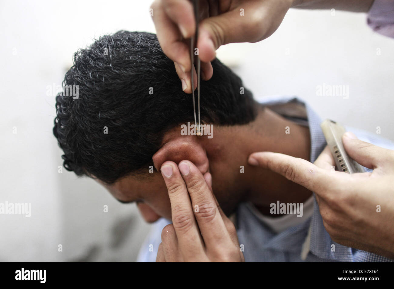 La bande de Gaza. 25 Septembre, 2014. Un Palestinien bee sting-thérapeute met une abeille sur la tête du patient dans la ville de Gaza, sur Sept 25, 2014. À l'abeille-sting clinique, les patients reçoivent un traitement par piqûres d'abeilles, pour de nombreuses maladies comme la polyarthrite rhumatoïde, maladies du coeur, des problèmes d'audition, l'insuffisance rénale, l'épilepsie, l'allergie nasale et l'autisme. © Wissam Nassar/Xinhua/Alamy Live News Banque D'Images
