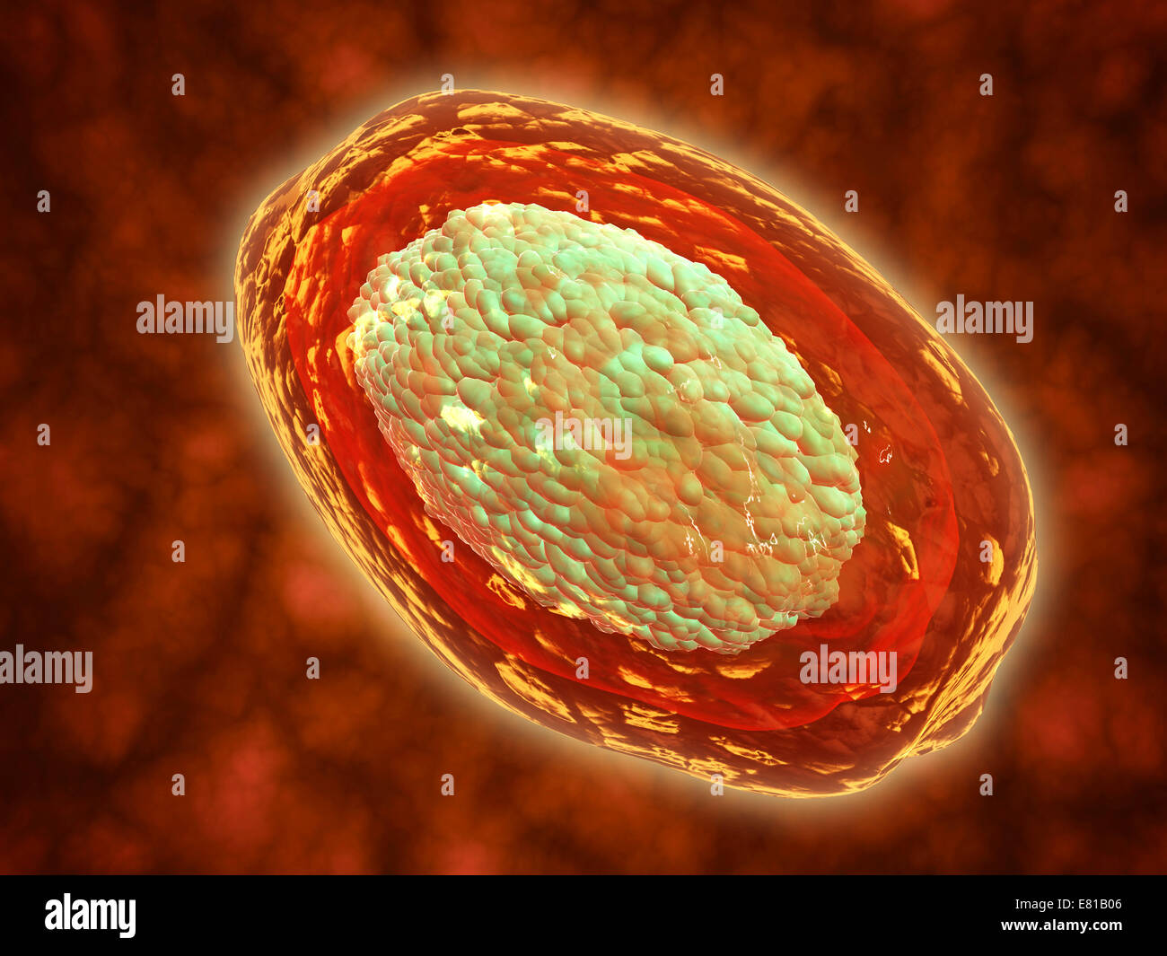 Vue microscopique de la variole. La variole est une maladie contagieuse aiguë localisée dans les petits vaisseaux sanguins de la peau, de la bouche et th Banque D'Images