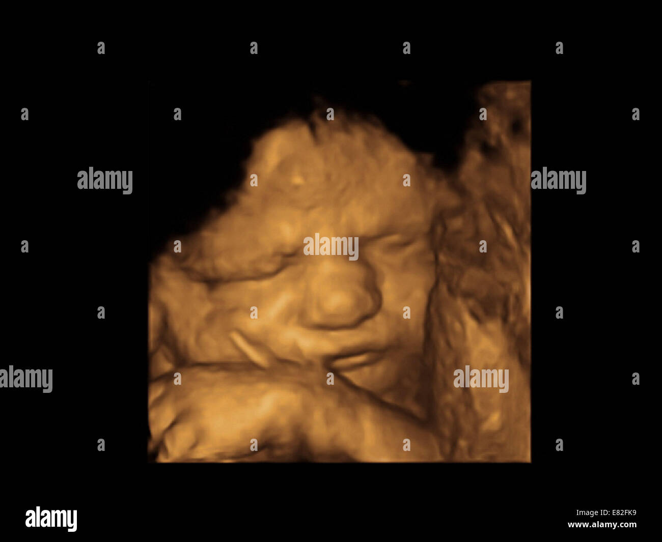 3d Ultrasound Foetus Banque D Image Et Photos Alamy