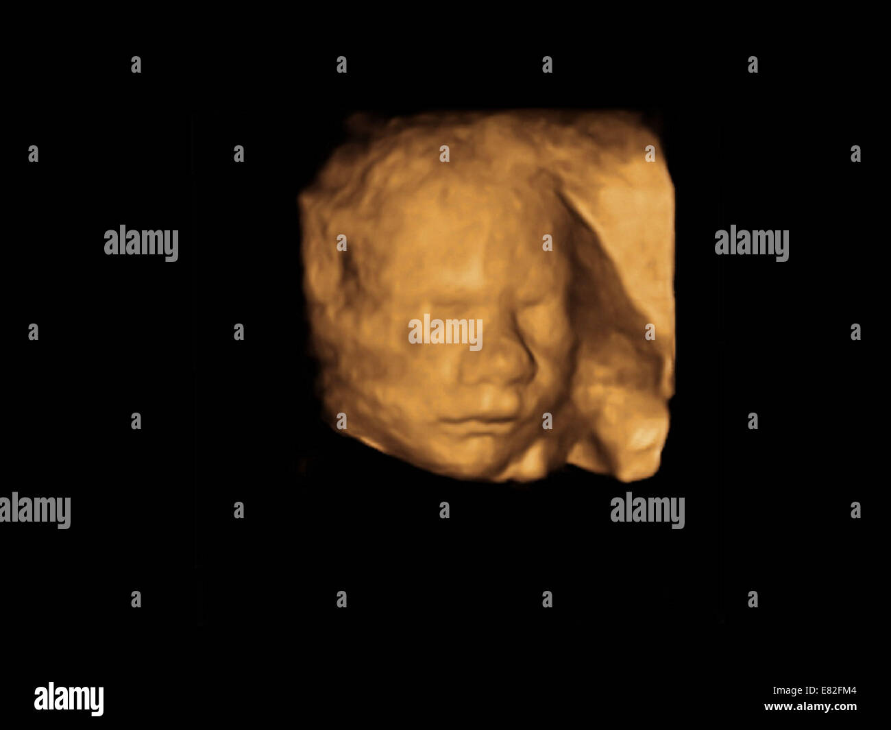 Foetus A 6 Semaines Banque D Image Et Photos Alamy