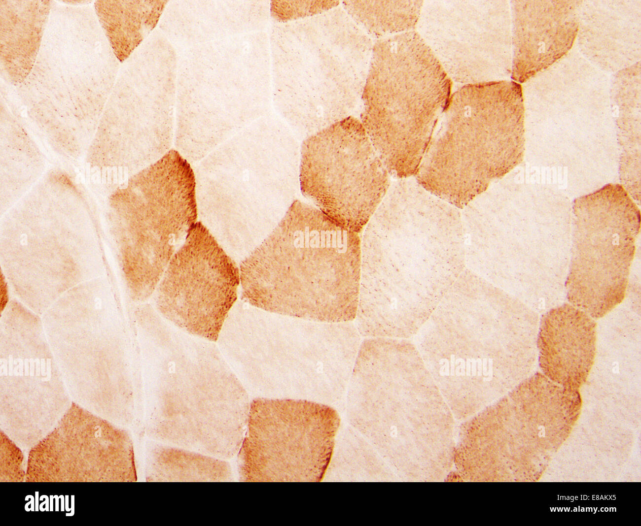 Les fibres musculaires normales Banque D'Images