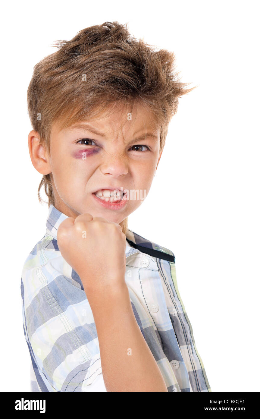 Garçon avec ecchymose Banque D'Images