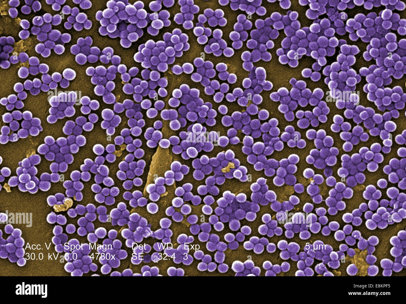 Cette colorisées, l'analyse des électrons Microphotographie (SEM) représenté de nombreuses colonies de Staphylococcus aureus résistant à la Banque D'Images