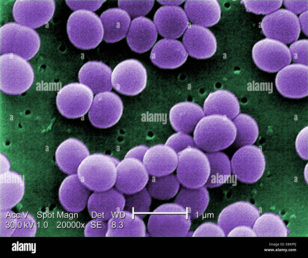 Sous très haute agrandissement de 20,000x, cette l'analyse des électrons  Microphotographie (SEM) montre souche de Staphylococcus aureus Photo Stock  - Alamy