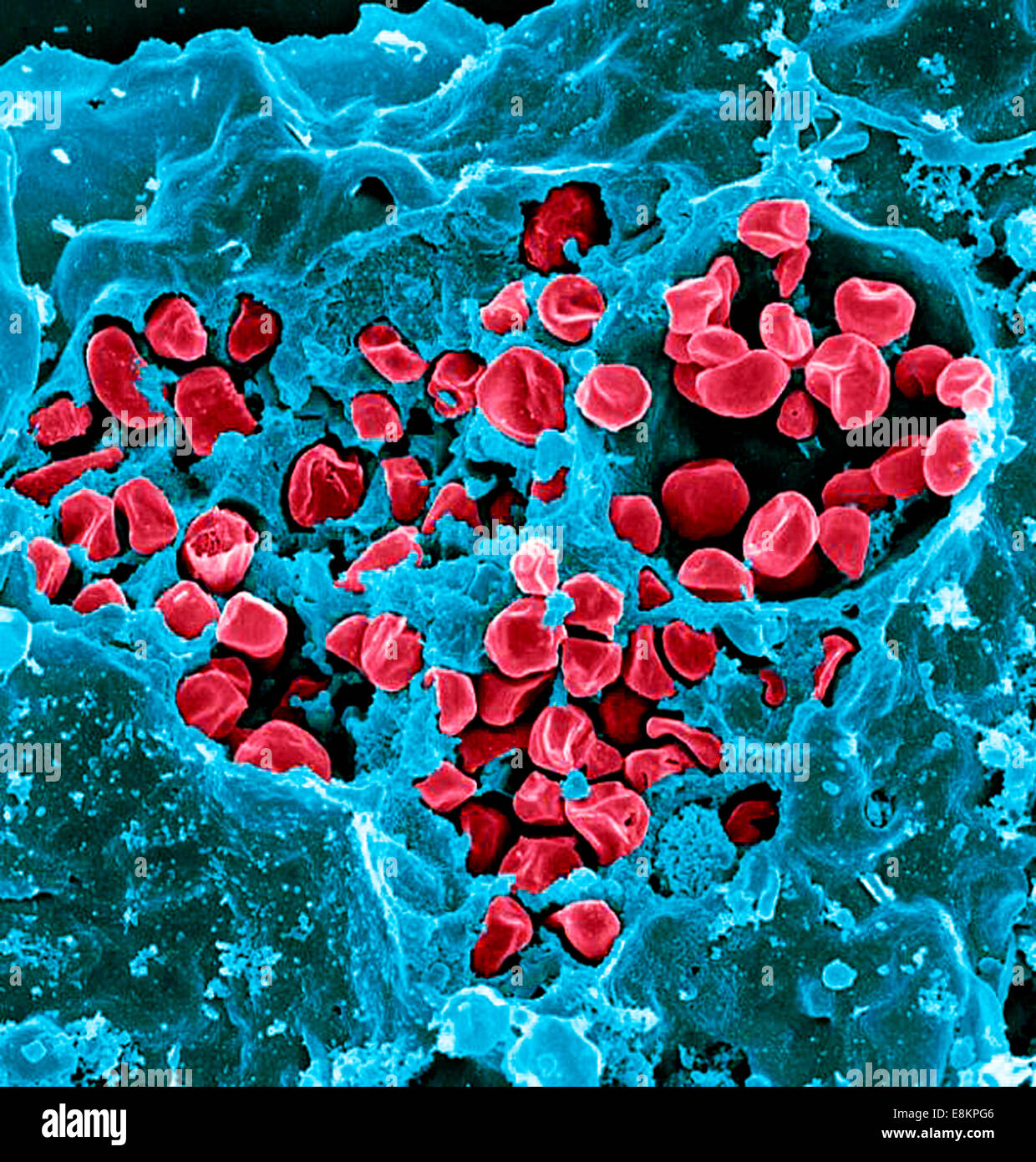 Micrographie électronique à balayage des macrophages murins infectés par Francisella tularensis LVS souche ont été macrophages Banque D'Images