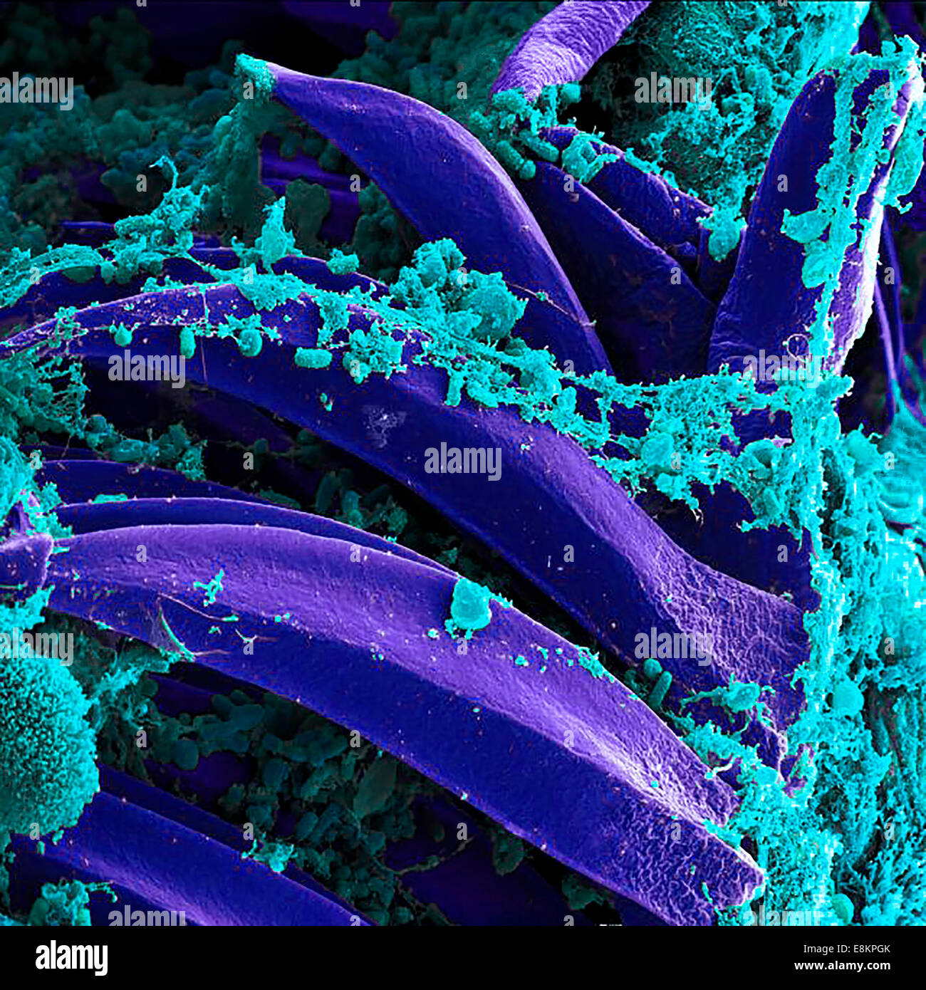 Micrographie électronique à balayage de Yersinia pestis, qui provoque la peste bubonique, sur des épines de Xenopsylla cheopis proventricular Banque D'Images
