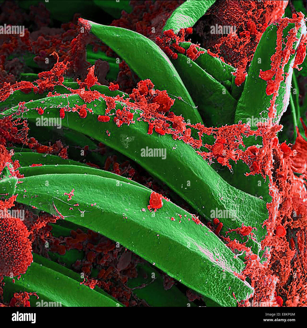 Micrographie électronique à balayage de Yersinia pestis, qui provoque la peste bubonique, sur des épines de Xenopsylla cheopis proventricular Banque D'Images