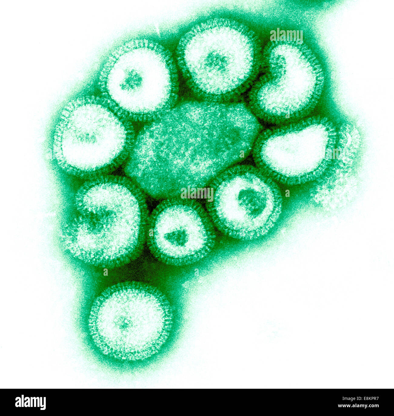 Cette colorées négativement colorisée micrographie électronique à transmission (TEM) illustre les détails ultrastructuraux de nombre de détections Banque D'Images