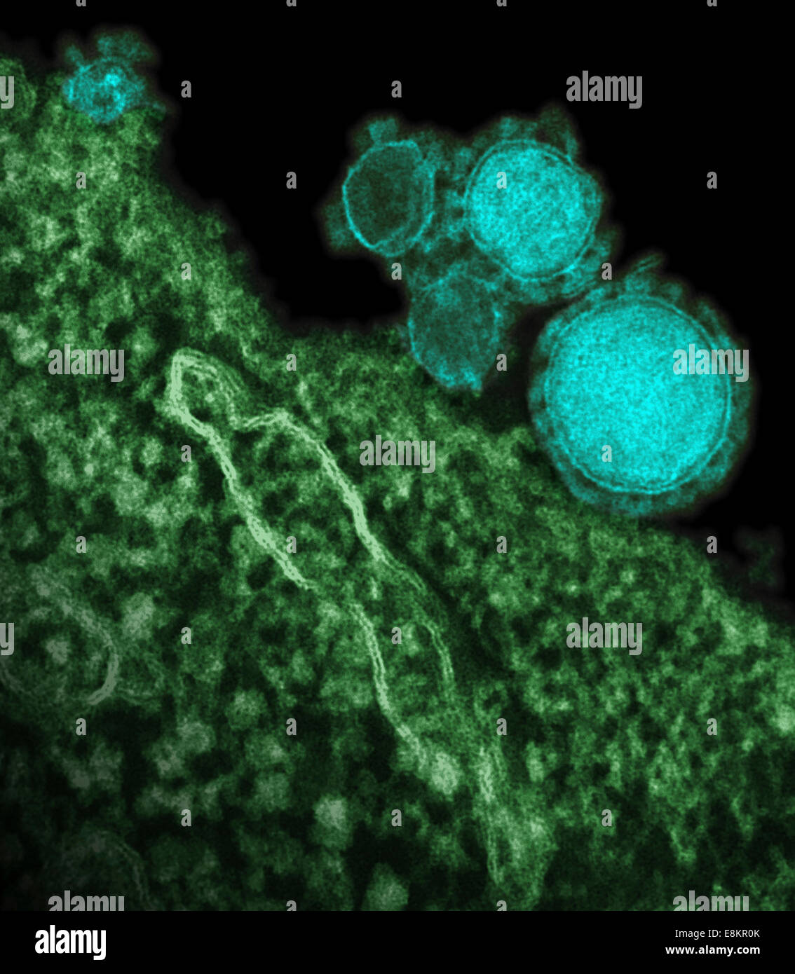 Micrographe colorisée du coronavirus du syndrome respiratoire du Moyen-Orient les particules. Banque D'Images