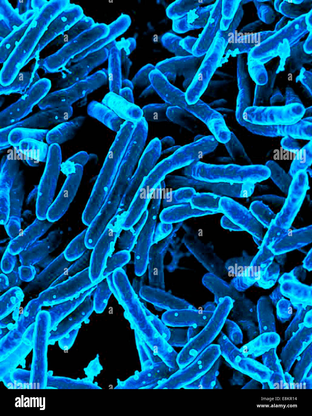 Micrographie électronique à balayage de la bactérie Mycobacterium tuberculosis, qui cause la tuberculose. Banque D'Images