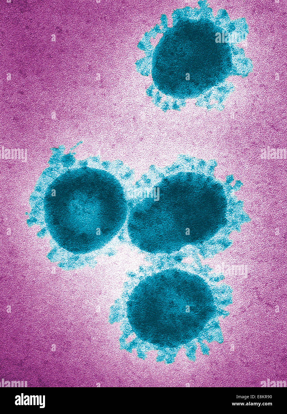 Cette colorisée numériquement micrographie électronique à transmission (MET) a révélé la présence de nombre de virus de la bronchite infectieuse Banque D'Images
