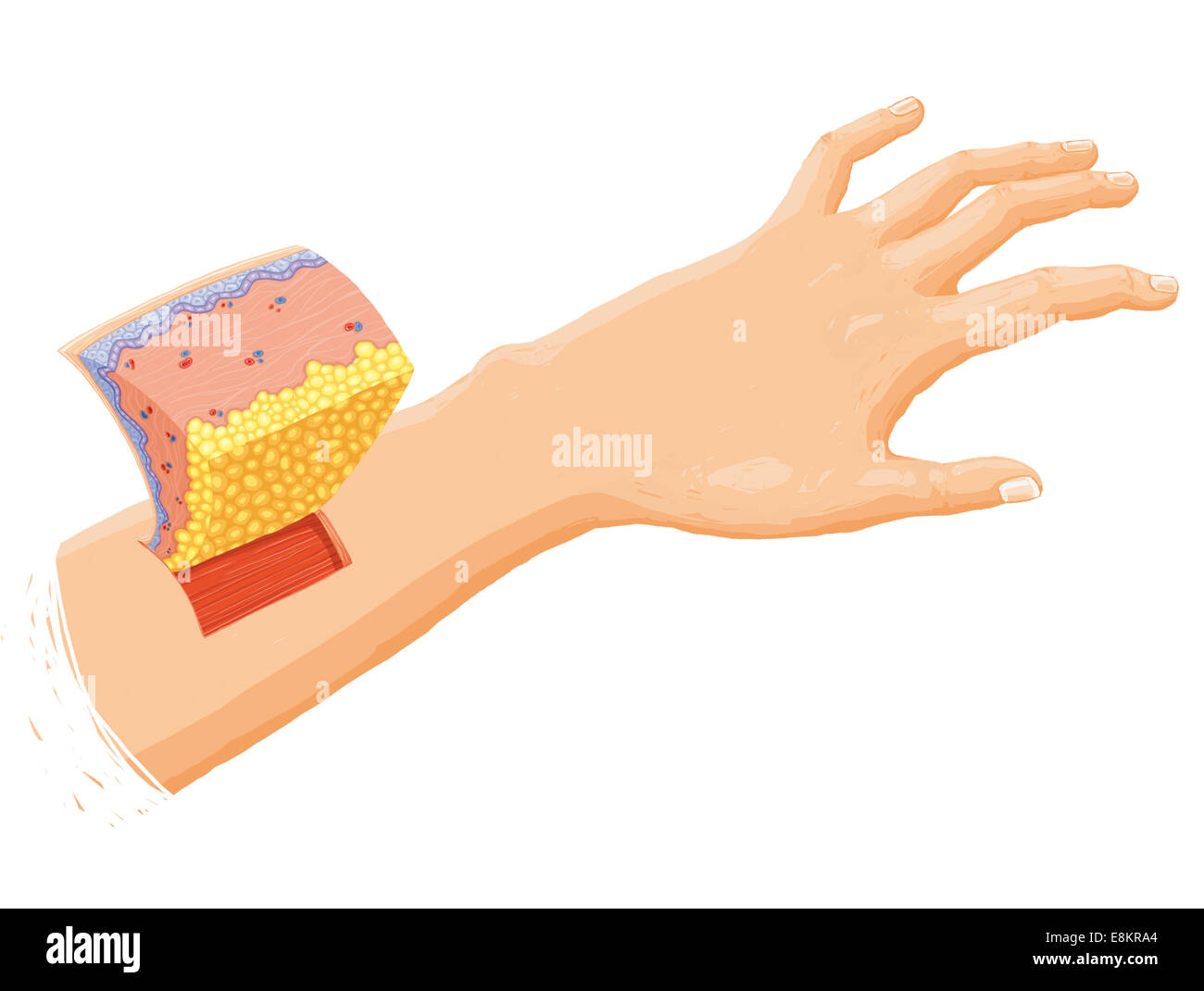 La section transversale de la peau. Banque D'Images