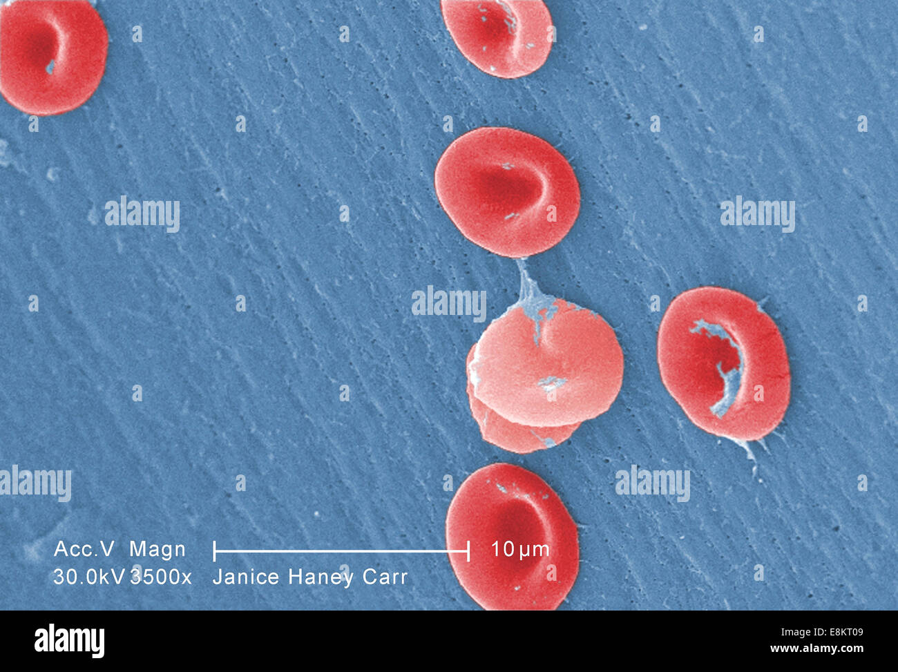 Cette colorisée numériquement l'analyse des électrons Microphotographie (SEM) a révélé une partie de la morphologie ultrastructurale affichée par le sang rouge Banque D'Images