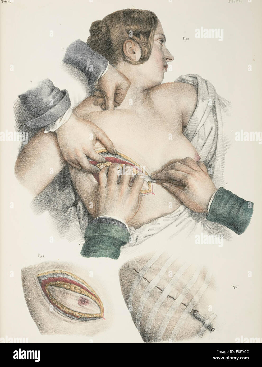 Apparaît dans : Bourgery, J. M. (Jean Marc), 1797-1849. Traité complet de l'anatomie de l'homme Image Description : Trois illustra Banque D'Images