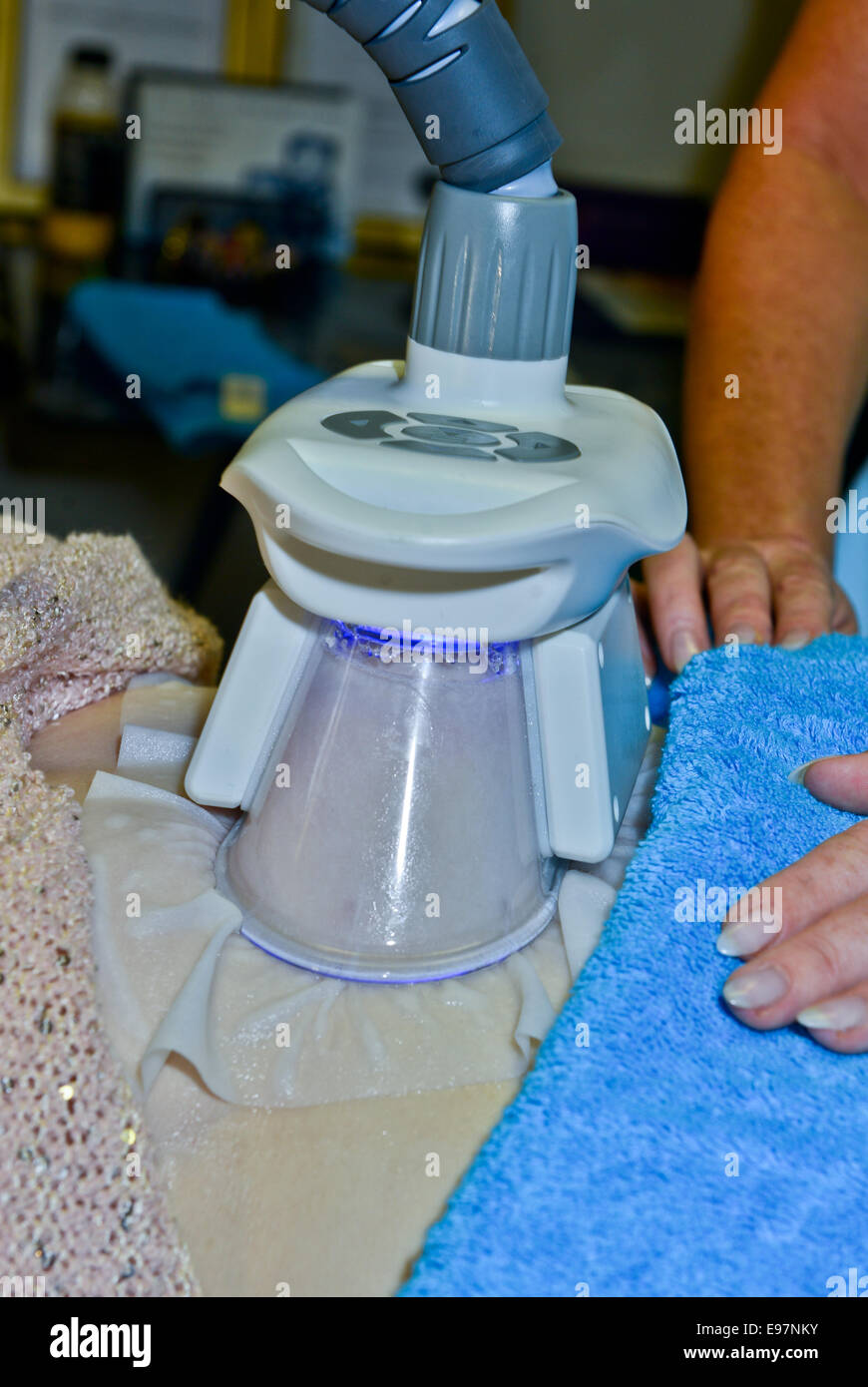 Gloucester, Royaume-Uni. 21 Oct, 2014. Gel de graisse à Gloucester avec  glace Lipo Cotswold Propriétaire Mel Pressman vu ici à l'aide  d'Cryolipolysis, également connu sous le nom de matières grasses ou de