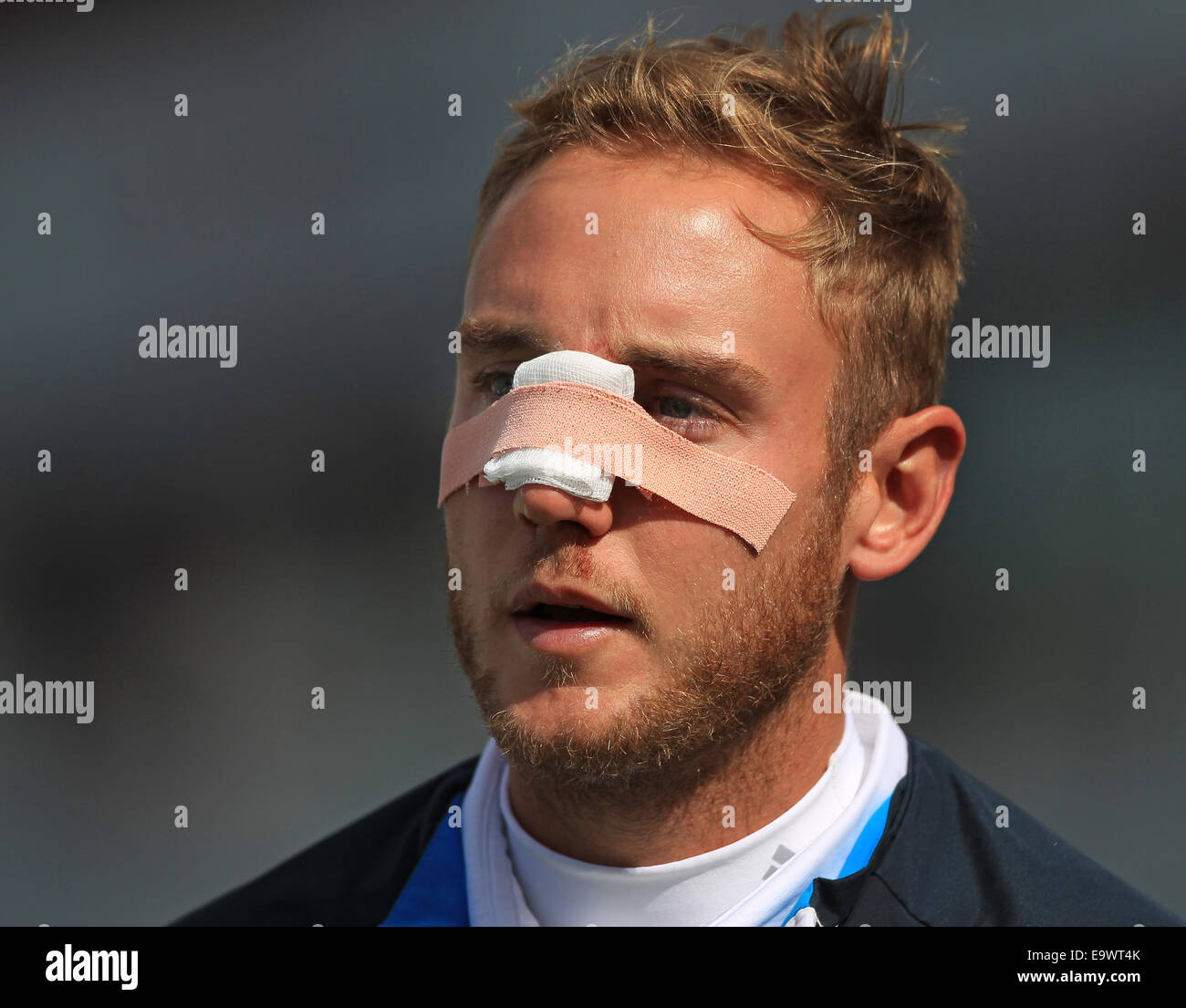 Cricket - Stuart large de l'Angleterre avec bandage et bande de plâtre sur son nez après avoir reçu des points de suture pour une blessure au visage Banque D'Images