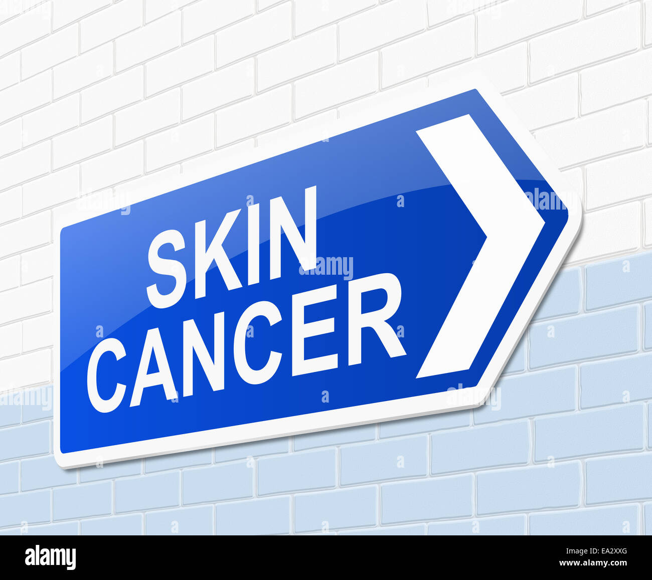 Concept du cancer de la peau. Banque D'Images