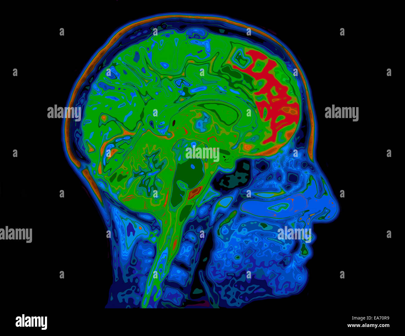 L'image IRM du cerveau montrant la tête Banque D'Images