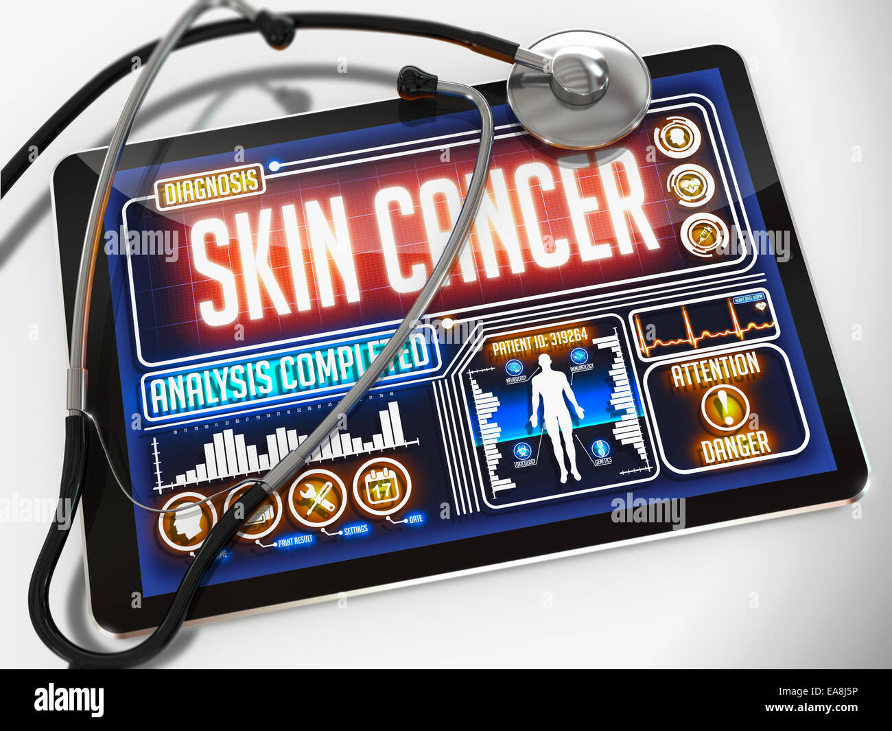Tablette médicale avec le diagnostic de cancer de la peau à l'écran et d'un stéthoscope noir sur fond blanc. Banque D'Images