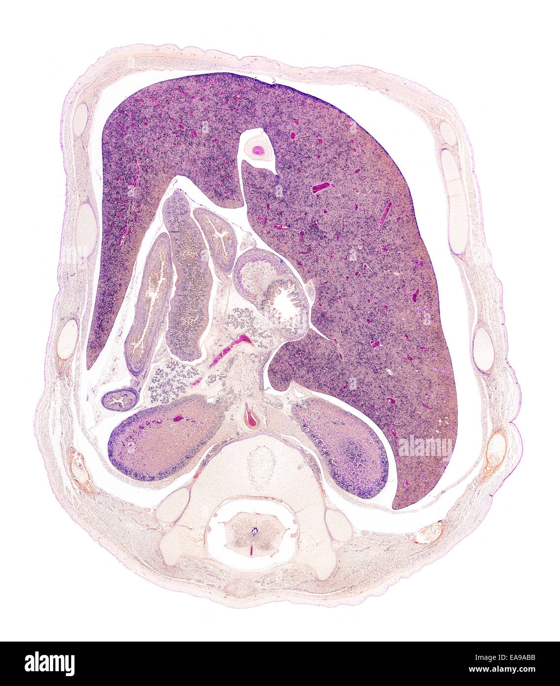 Foetus humain thorax section Vitrail montrant structures générales Banque D'Images