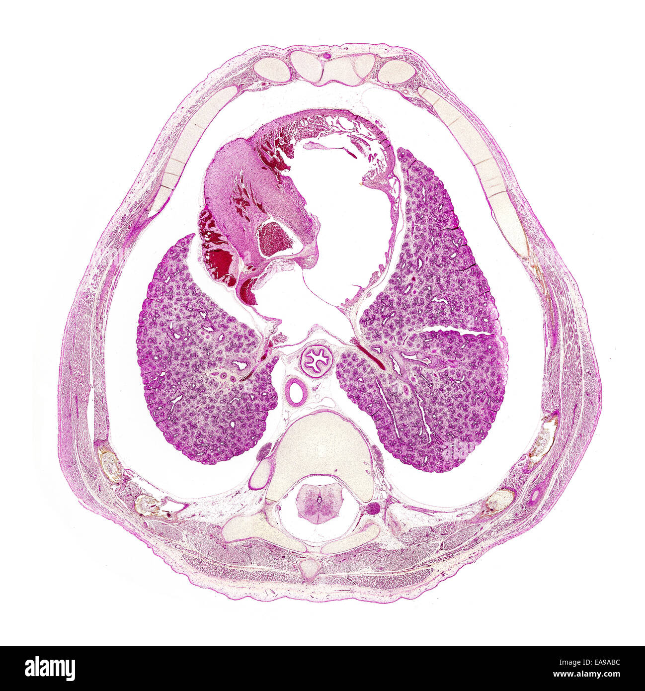 Foetus humain thorax section Vitrail montrant structures générales Banque D'Images