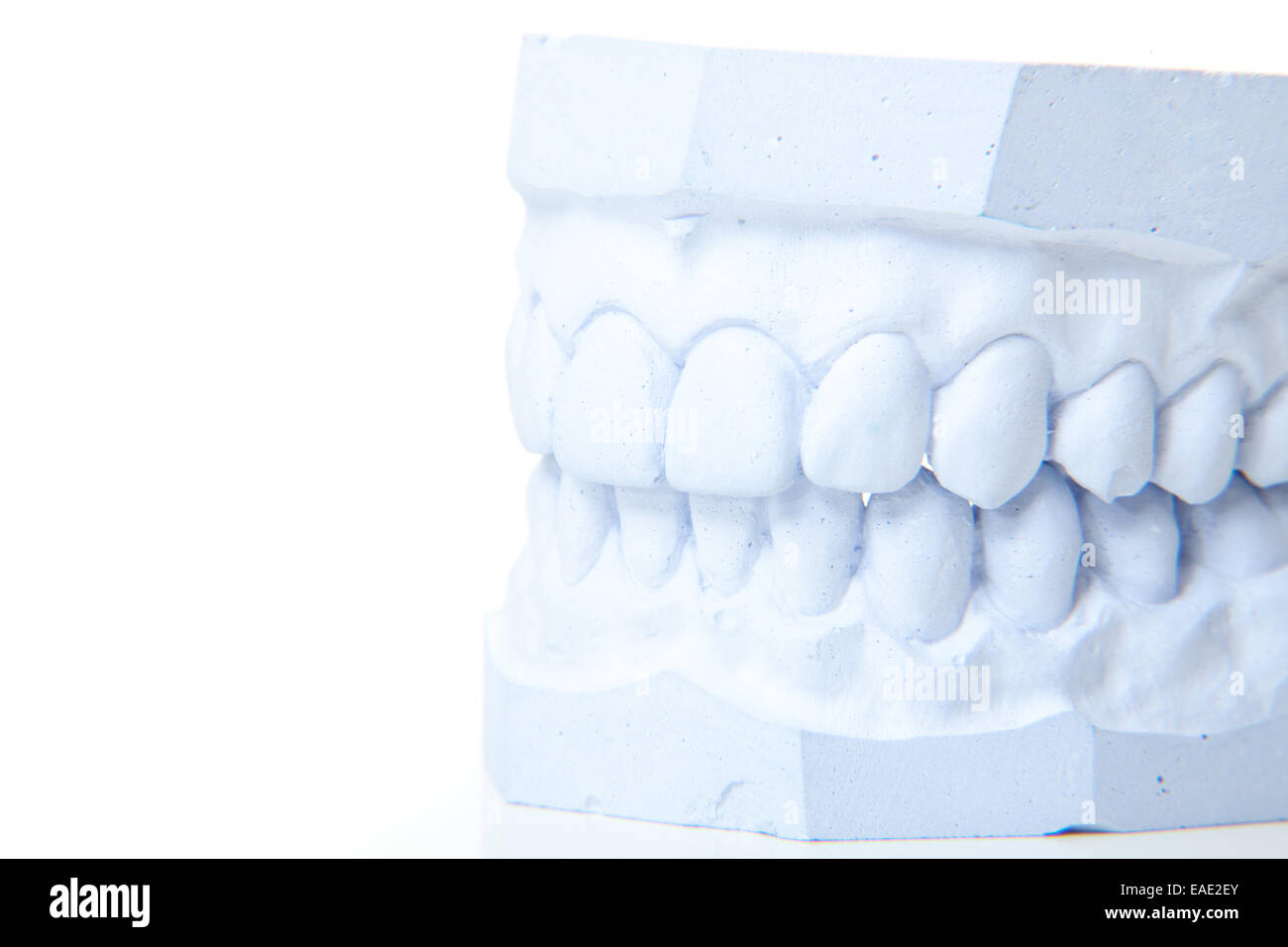 Plâtre de dents parfaites. Le tout sur fond blanc. Banque D'Images