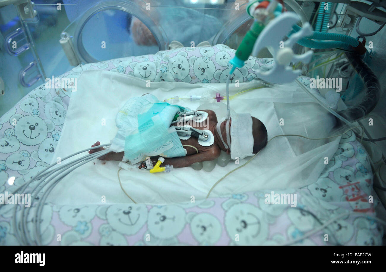 Un Poids De 660 Grammes A La Naissance Prematuree De Bebe Qui A Ete Force A Abandonner Les 23 Semaines Ont Survecu A Chongqing Sichuan Chine Le 18 Novembre 14 La Raison