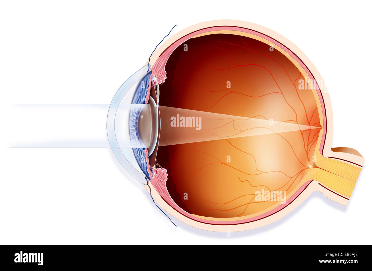 IMPLANT DE LENTILLES Banque D'Images