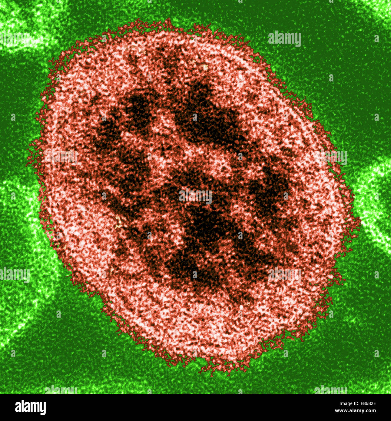 Virus de la rougeole Banque de photographies et d’images à haute ...