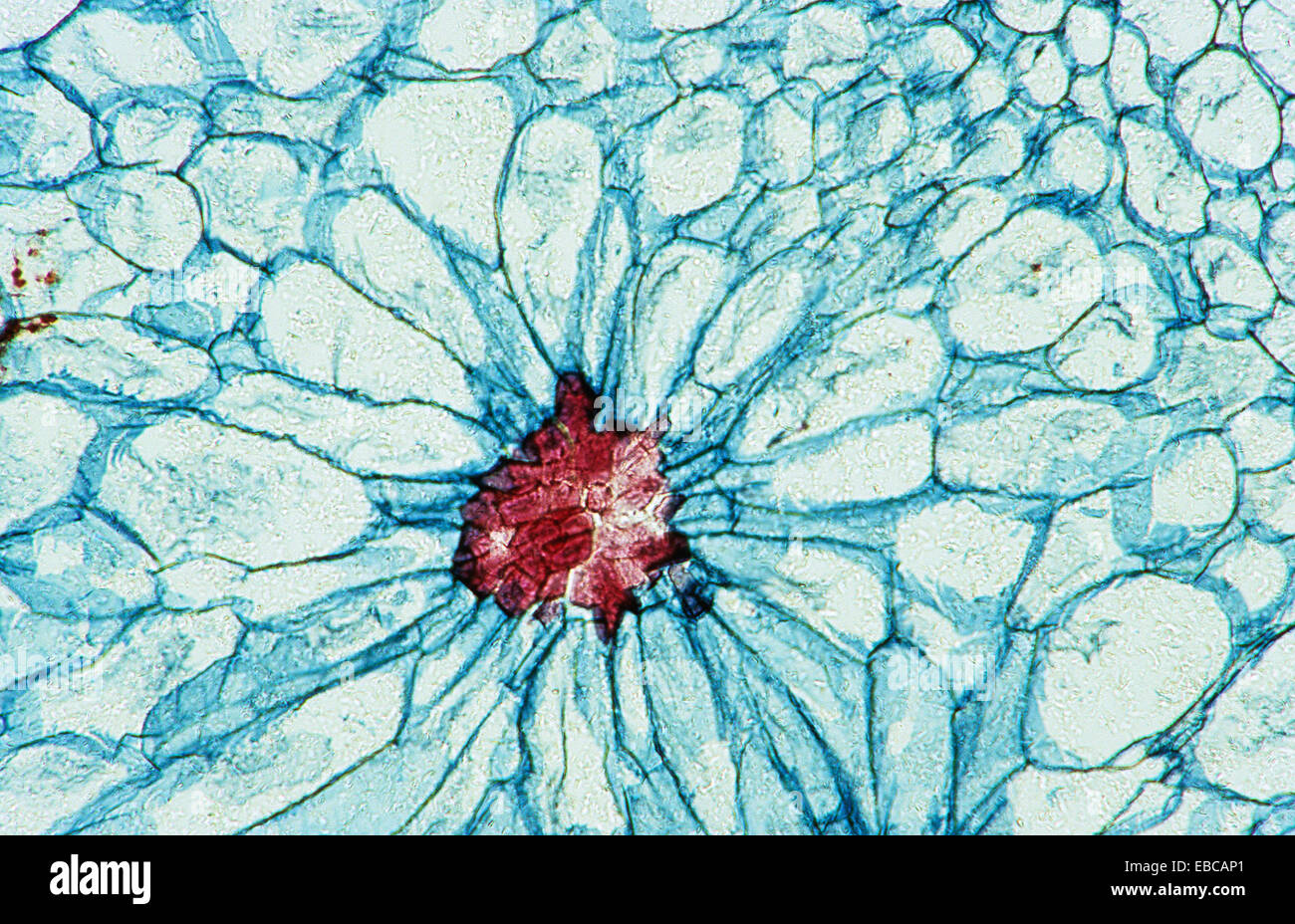 Cellule De Pierre Corps Cystolithique Carbonate De Calcium 100 X Microscope Optique La Photomicrographie Anatomie Vegetale Botanique Photo Stock Alamy Cellule De Pierre Corps Cystolithique Carbonate De Calcium 100 X Microscope Optique La Photomicrographie Anatomie Vegetale Botanique Photo Stock Alamy