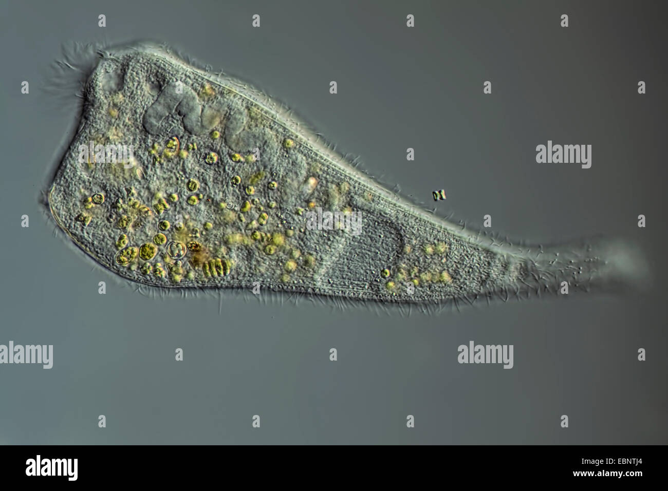 Trompette animalcules (Stentor spec.), en contraste d'interférence différentielle Banque D'Images