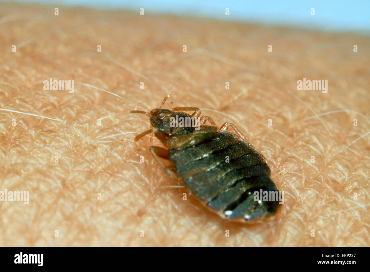 Vladimir Maïakovski, commune de Vladimir Maïakovski, Mur-louse (Cimex lectularius), sur la peau humaine Banque D'Images Vladimir Maïakovski, commune de Vladimir Maïakovski, Mur-louse (Cimex lectularius), sur la peau humaine Banque D'Images