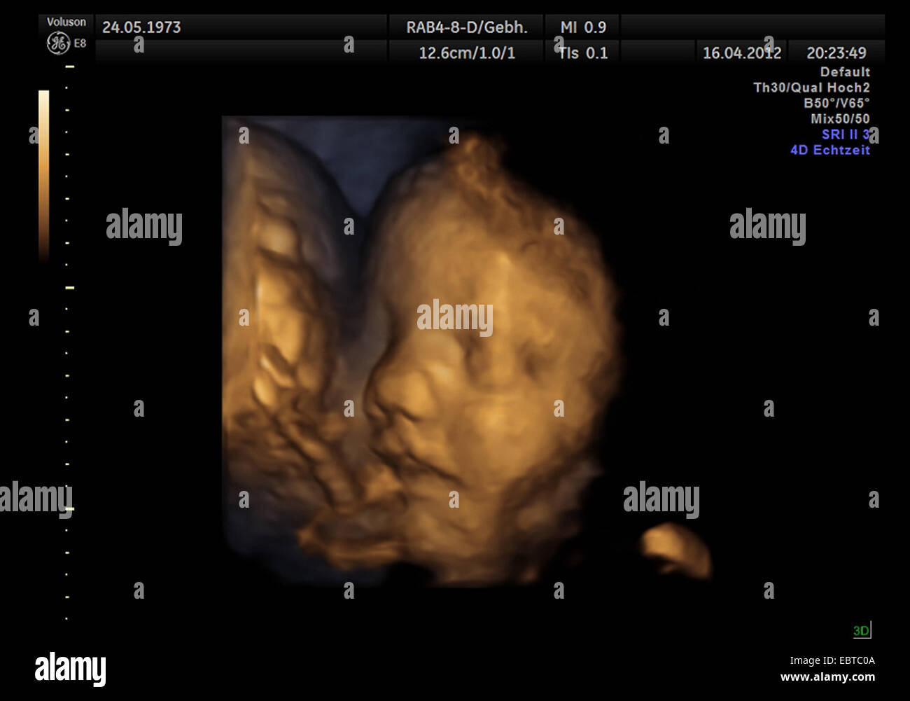 Portrait 4D d'un embryon dans l'utérus Banque D'Images
