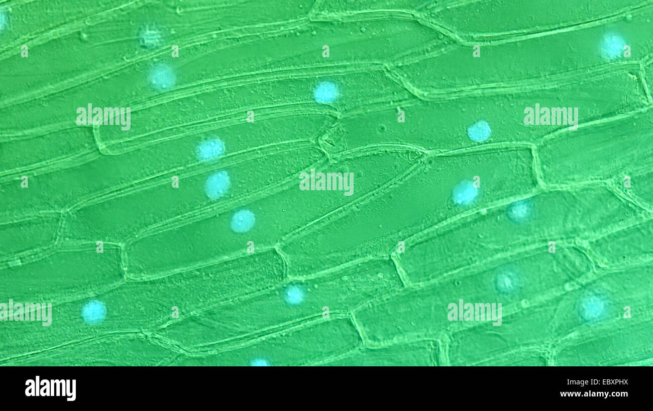 Les parois des cellules et des organites des cellules épidermiques d'oignon à l'échelle de l'ampoule Banque D'Images