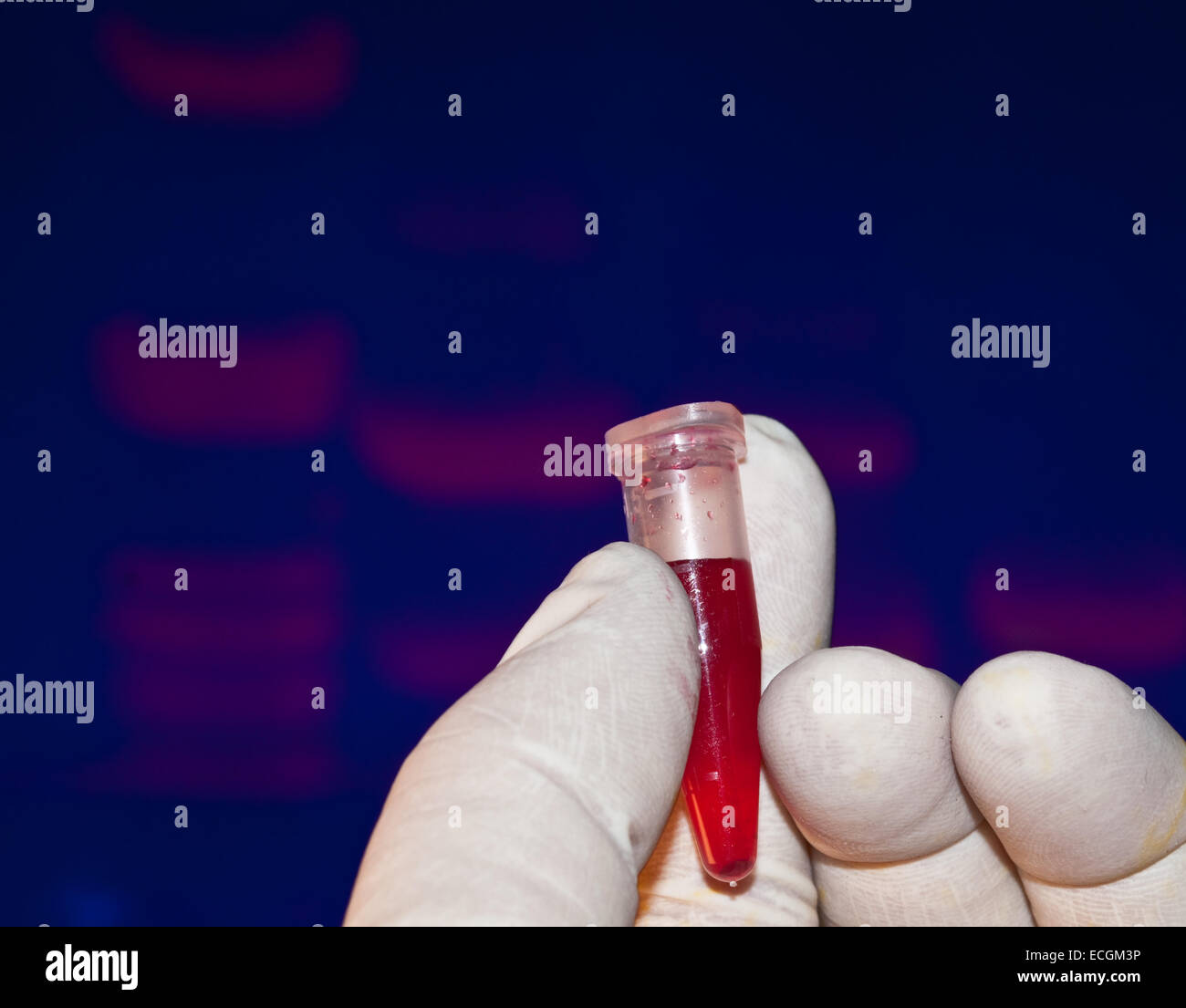 Examen de sang au laboratoire. Le tube de sang au milieu d'electrophoregram. Banque D'Images