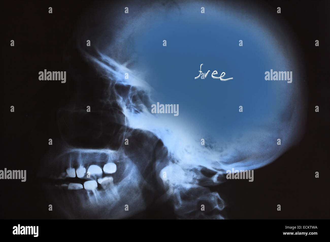 X-Ray de crâne humain avec un espace bleu. Banque D'Images